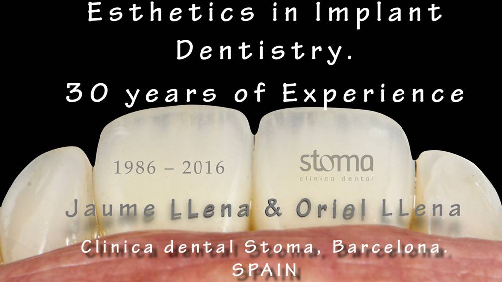 Curs "Estètica en Odontologia Implant. 30 anys d'experiència"
